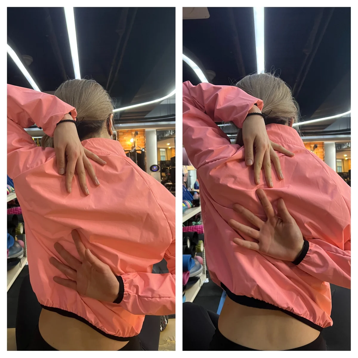 굽은등 교정 - 교정 전후 비교 사진